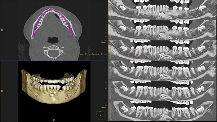 dental planning thumbnail