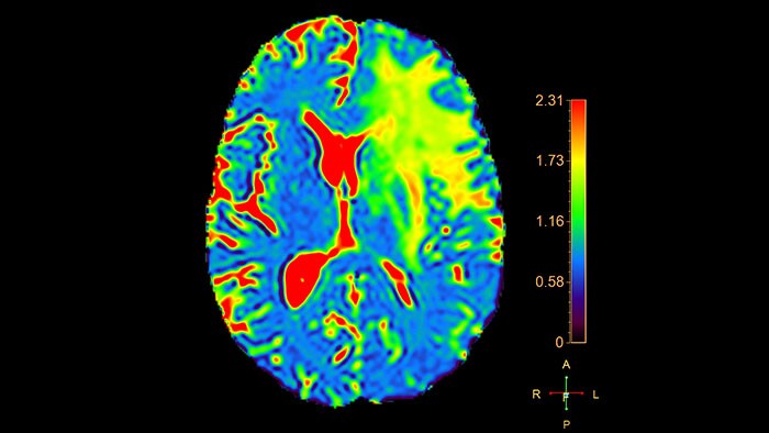 magnetic resonance diffusion