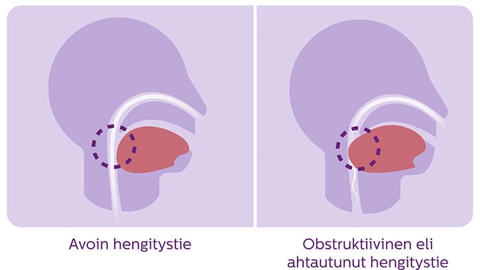 uniapneakaavio image