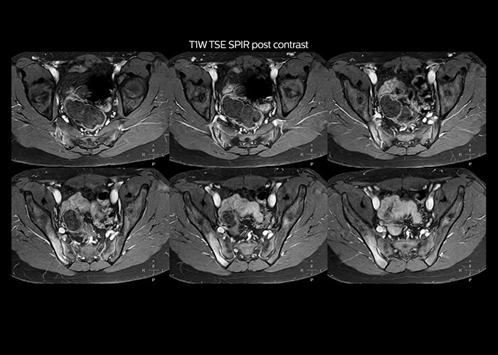 clinical cases tab2 image