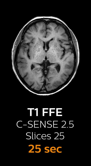 T1 FFE magnetic resonance