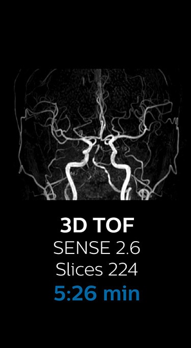 3D TOF image