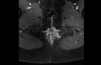 Pelvis image