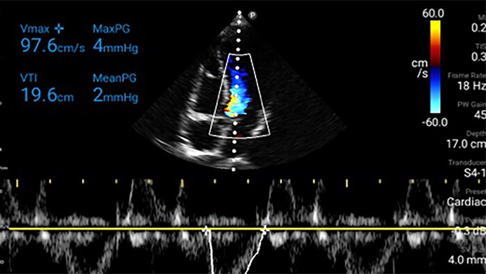 Cardiac chart thumbnail