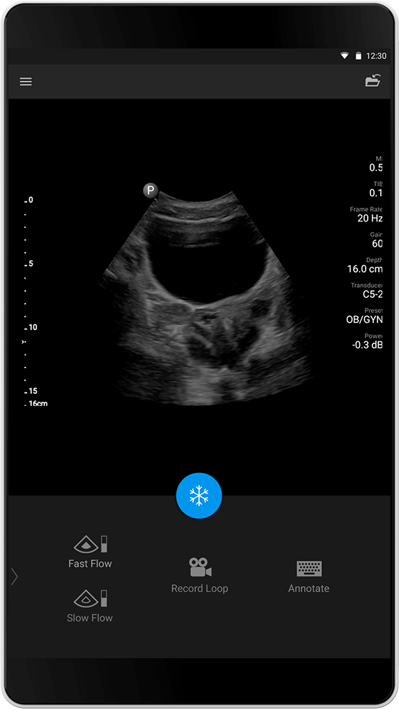 OB/GYN-tutkimus C5-2