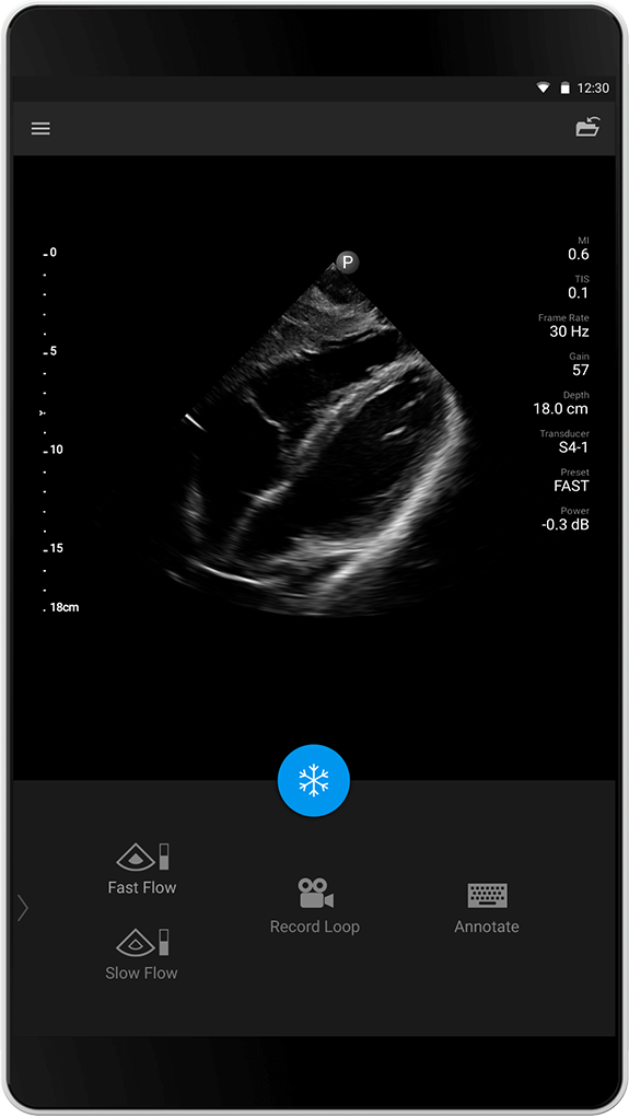 FAST-tutkimus S4-1