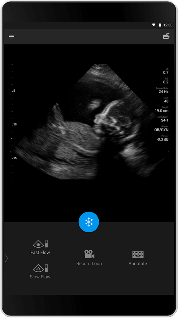 OB/GYN-tutkimus S4-1