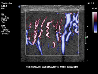 Testicles MCPA