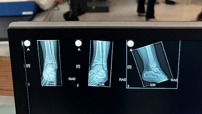 X-ray of the ankle, Drammen Hospital